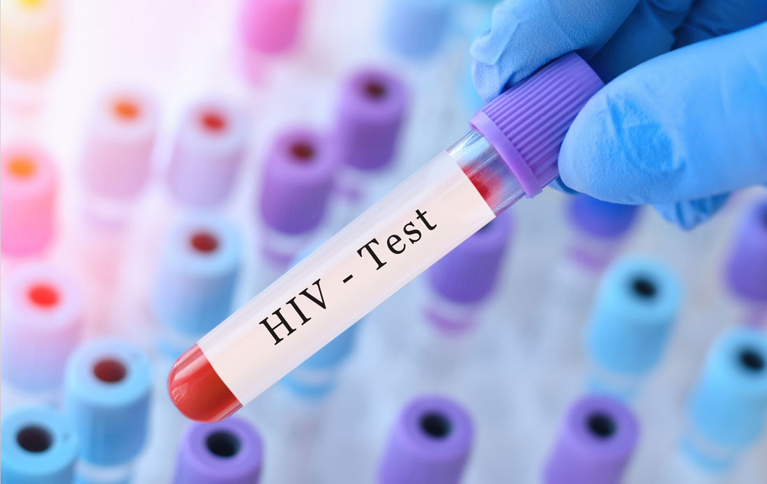 The Importance of Regular HIV Testing