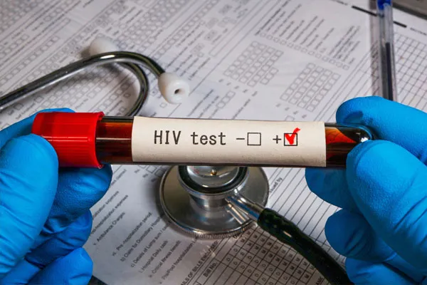 A doctor holding an HIV blood test sample