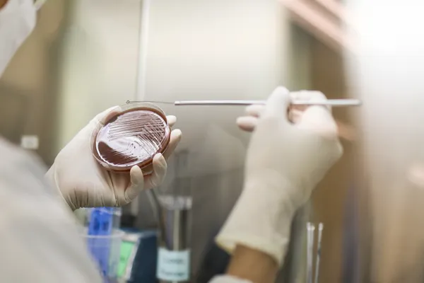 A doctor carrying out a gonorrhoea test