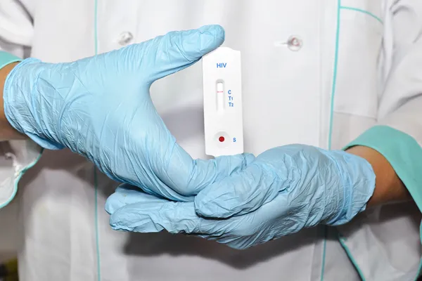 A doctor holding an HIV test kit